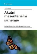 Akutní mezenteriální ischemie - Elektronická kniha