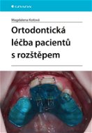 Ortodontická léčba pacientů s rozštěpem - Elektronická kniha