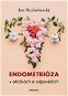 Endometrióza v otázkách a odpovědích - Elektronická kniha
