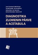 Diagnostika zlomenin pánve a acetabula - E-kniha