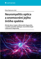 Neuromyelitis optica and disorders of its broader spectrum - Ebook