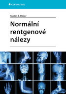 Normal X-ray findings - Ebook