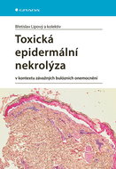 Toxic epidermal necrolysis - Ebook