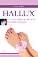 Hallux - Ebook