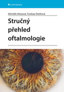 Stručný přehled oftalmologie - Ebook