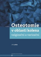 Osteotomie v oblasti kolena: valgizační a varizační - Kniha