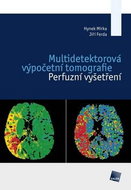 Multidetektorová výpočetní tomografie: Perfuzní vyšetření - Kniha
