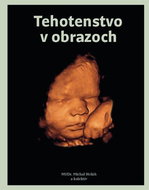 Tehotenstvo v obrazoch - Kniha