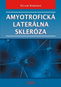 Amyotrofická laterálna skleróza - Kniha