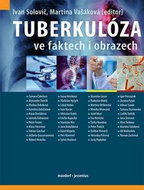 Tuberkulóza ve faktech i obrazech - Kniha
