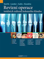 Revizní operace totálních náhrad kolenního kloubu - Kniha