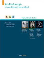 Kardiochirurgie v instruktivních kazuistikách - Kniha