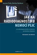 Jak na radiodiagnostiku nemocí plic - Kniha