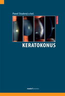 Keratokonus - Kniha
