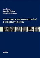 Protokoly v MR zobrazování: Pokročilé techniky - Kniha