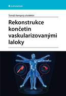 Rekonstrukce končetin vaskularizovanými laloky - Kniha