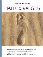 Hallux valgus - Kniha