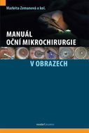 Manuál oční mikrochirurgie v obrazech - Kniha