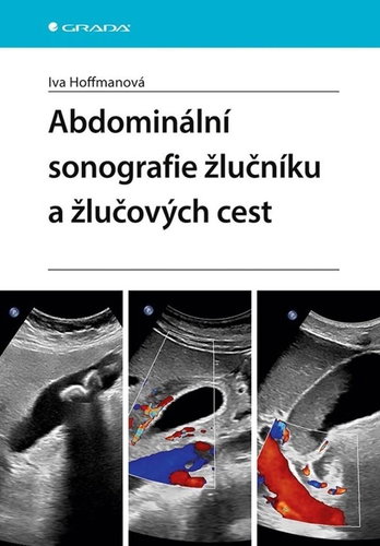 Abdominální sonografie žlučníku a žlučových cest - Kniha - Hlavní obrázek