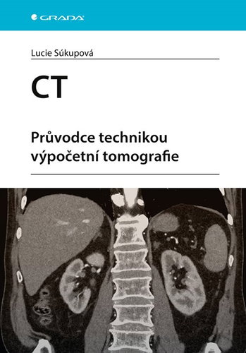 CT: Průvodce technikou výpočetní tomografie - Kniha - Main image