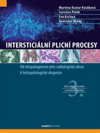 Intersticiální plicní procesy - Kniha
