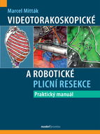 Videotorakoskopické a robotické plicní resekce: Praktický manuál - Kniha