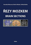 Řezy mozkem: Atlas makroskopických, mikroskopických a MRI řezů - Kniha