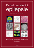 Farmakorezistentní epilepsie - Kniha