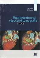 Multidetektorová výpočetní tomografie srdce - Kniha