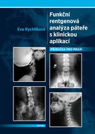 Funkční rentgenová analýza páteře s klinickou aplikací - Kniha