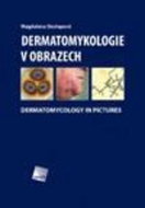 Dermatomykologie v obrazech - Kniha