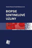 Biopsie sentinelové uzliny - Kniha