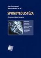 Spondylolistéza: Diagnostika a terapie - Kniha