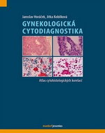 Gynekologická cytodiagnostika: Atlas cytohistologických korelací - Kniha