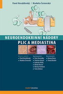 Neuroendokrinní nádory plic a mediastina - Kniha
