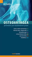Osteoartróza - Kniha