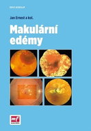 Makulární edémy - Kniha