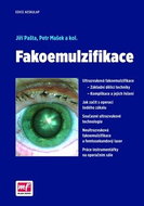 Fakoemulzifikace - Kniha