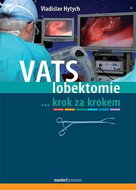VATS lobektomie: ...krok za krokem - Kniha