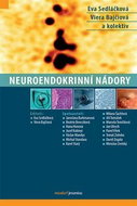 Neuroendokrinní nádory - Kniha