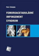 Femoroacetabulární impingement syndrom - Kniha