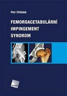 Femoroacetabulární impingement syndrom - Kniha