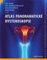 Atlas panoramatické hysteroskopie - Kniha