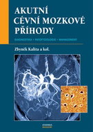 Akutní cévní mozkové příhody - Kniha
