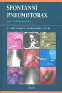 Spontánní pneumotorax: Etiopatogeneze, diagnostika, léčba - Kniha