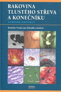 Rakovina tlustého střeva a konečníku - Kniha