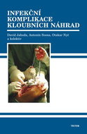Infekční komplikace kloubních náhrad - Kniha