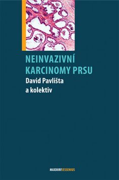 Neinvazivní karcinomy prsu - Kniha - Main image