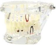 Verk 01964 Model zubných implantátov biela - Edukačná hračka