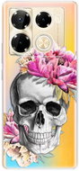 iSaprio Pretty Skull - Infinix Note 40 PRO / Note 40 PRO+ 5G - Phone Cover